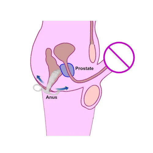 Javtoys Anal QY Prostate Stimulator Plug L